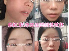 七老激素脸内调外修,恢复健康肤质,健康体质