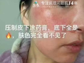 七老激素脸修护案例