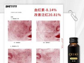 七老姜黄抗炎饮