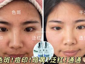 七老传明酸→色沉,斑斑,暗黄暗沉,红黑脸,黑红脸用起来