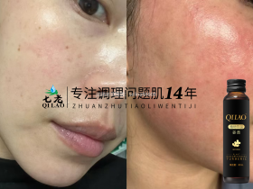 七老内调姜黄抗炎饮