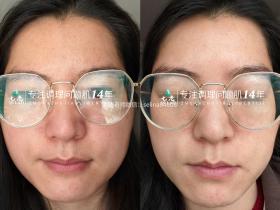 七老四重肽胶原蛋白,紧致抗衰减龄肌