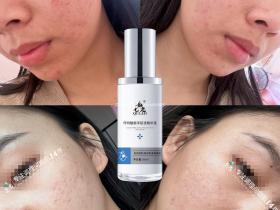 七老传明酸反馈好评