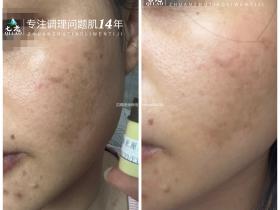 七老新品胶原水光→肌底修护,紧致抗衰于一体,让你皮肤胶原蛋白满满紧致白亮有光泽