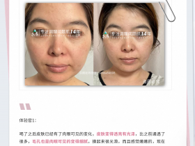 七老四重肽胶原蛋白修护案例