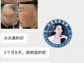 七老红血丝角质层薄红烫皮修护案例