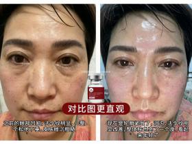 七老胶原水光,家居水光,补充胶原,修护紧致抗衰