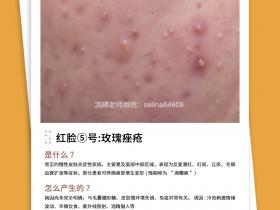 七老洪晴专业知识科普→一分钟教你辨别大红脸的类型