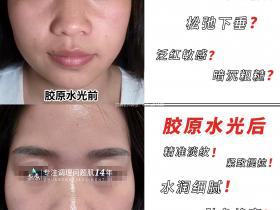 七老胶原水光修护抗皱原液
