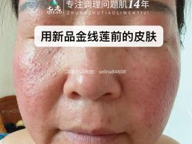 七老金线莲新品内测案例