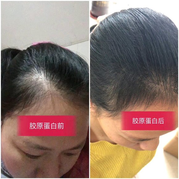 七老燕窝胶原蛋白肽口服液有哪些好处？