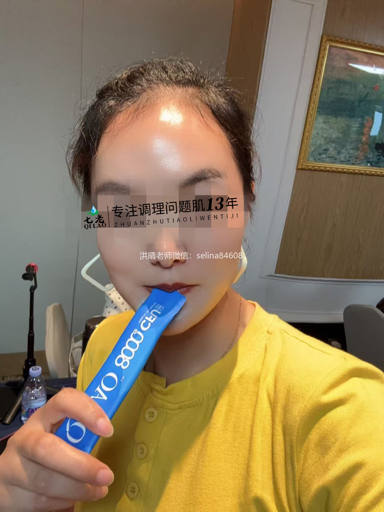 七老激素脸玫瑰修护案例