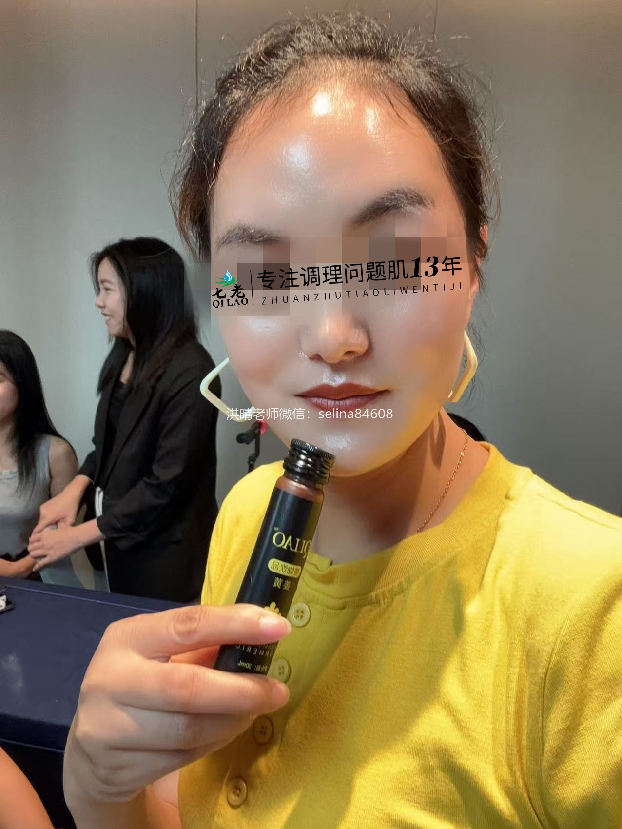 七老激素脸玫瑰修护案例
