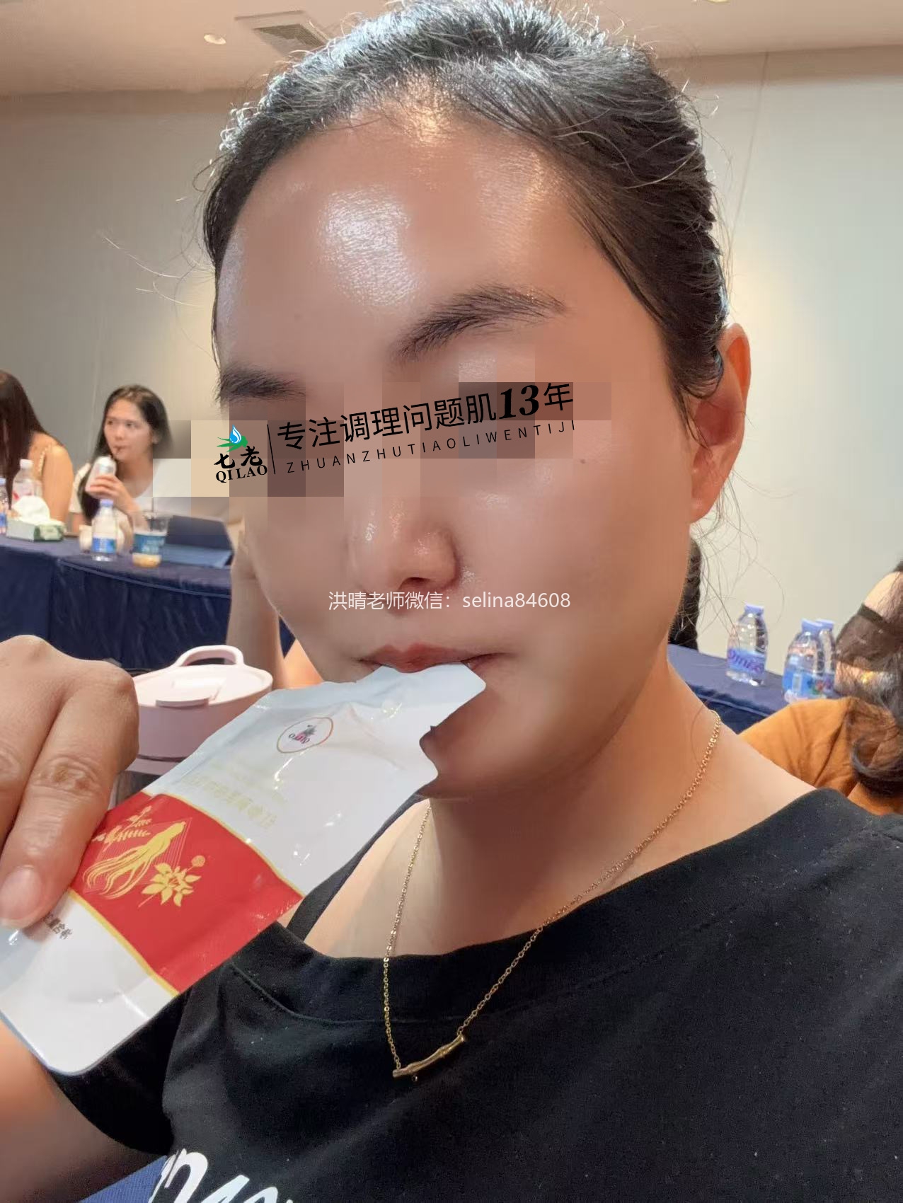 七老激素脸玫瑰修护案例
