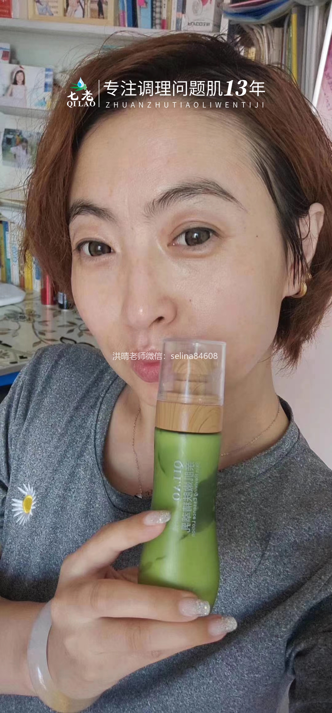 七老激素脸红肿痒疹子眼睛反复过敏修护案例
