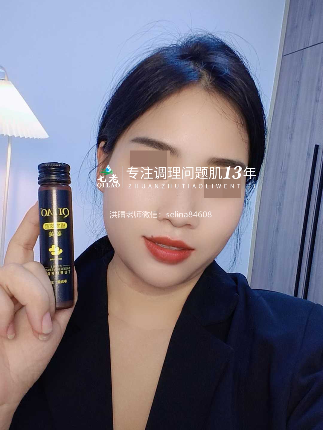 七老眼睛眼周红肿痒疹子过敏修复案例