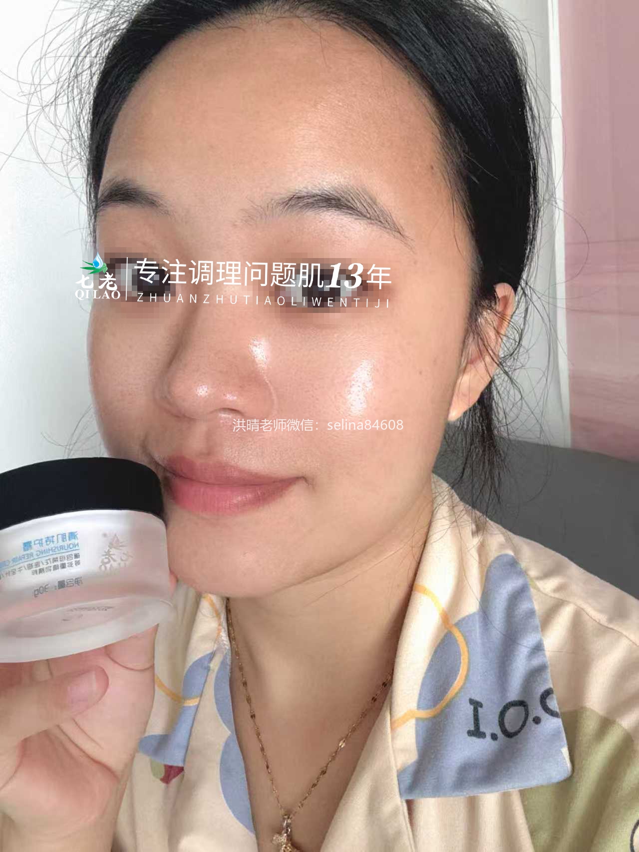 七老激素脸修护案例