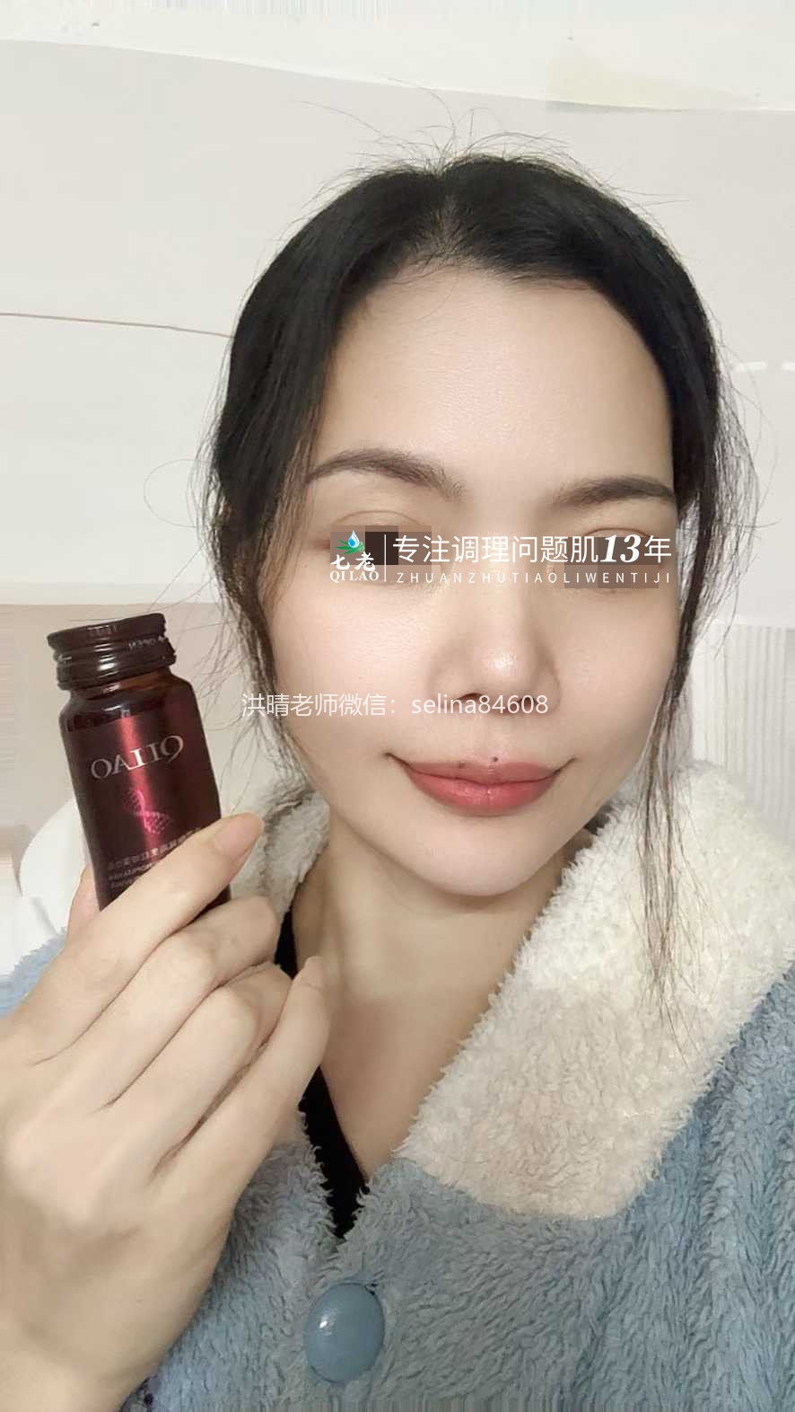 七老严重激素脸修护案例