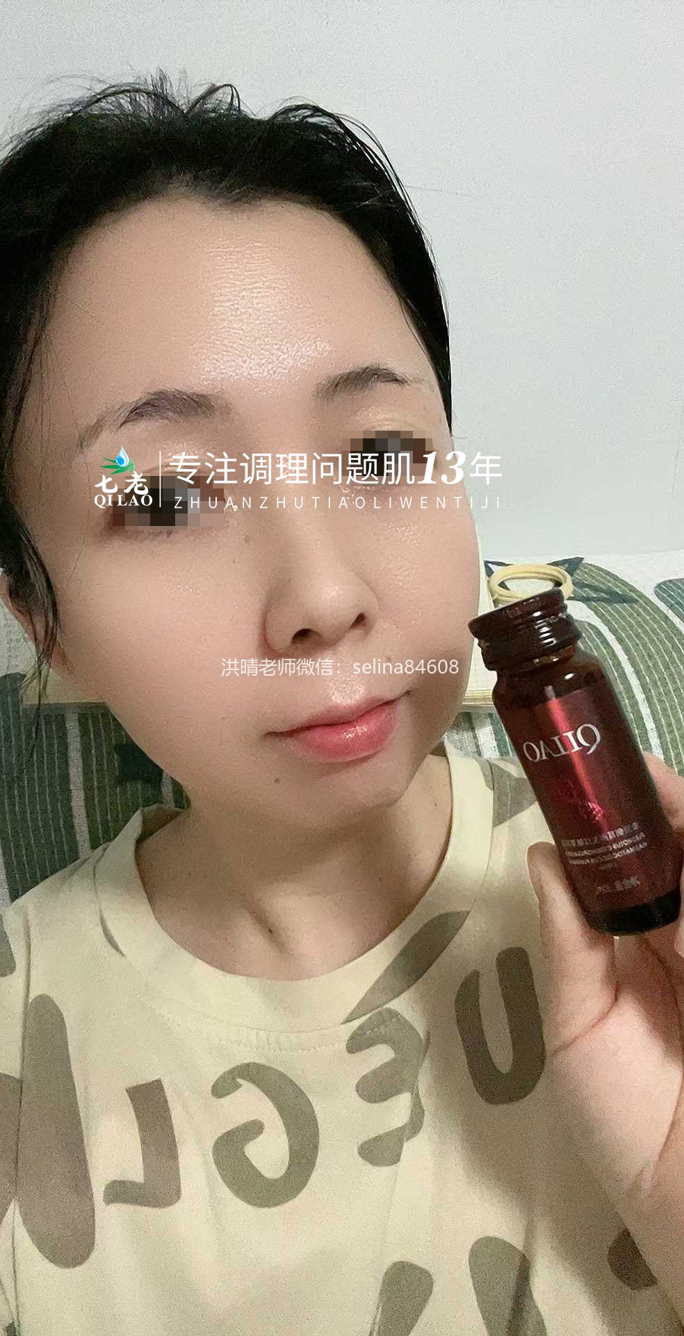 七老大红脸修护案例