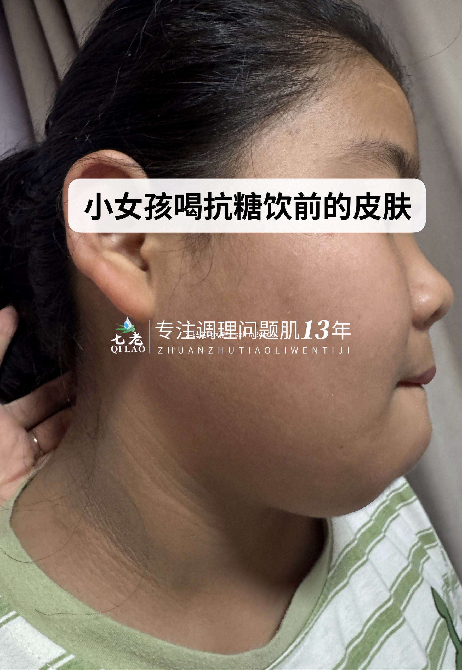 七老美白抗糖饮反馈