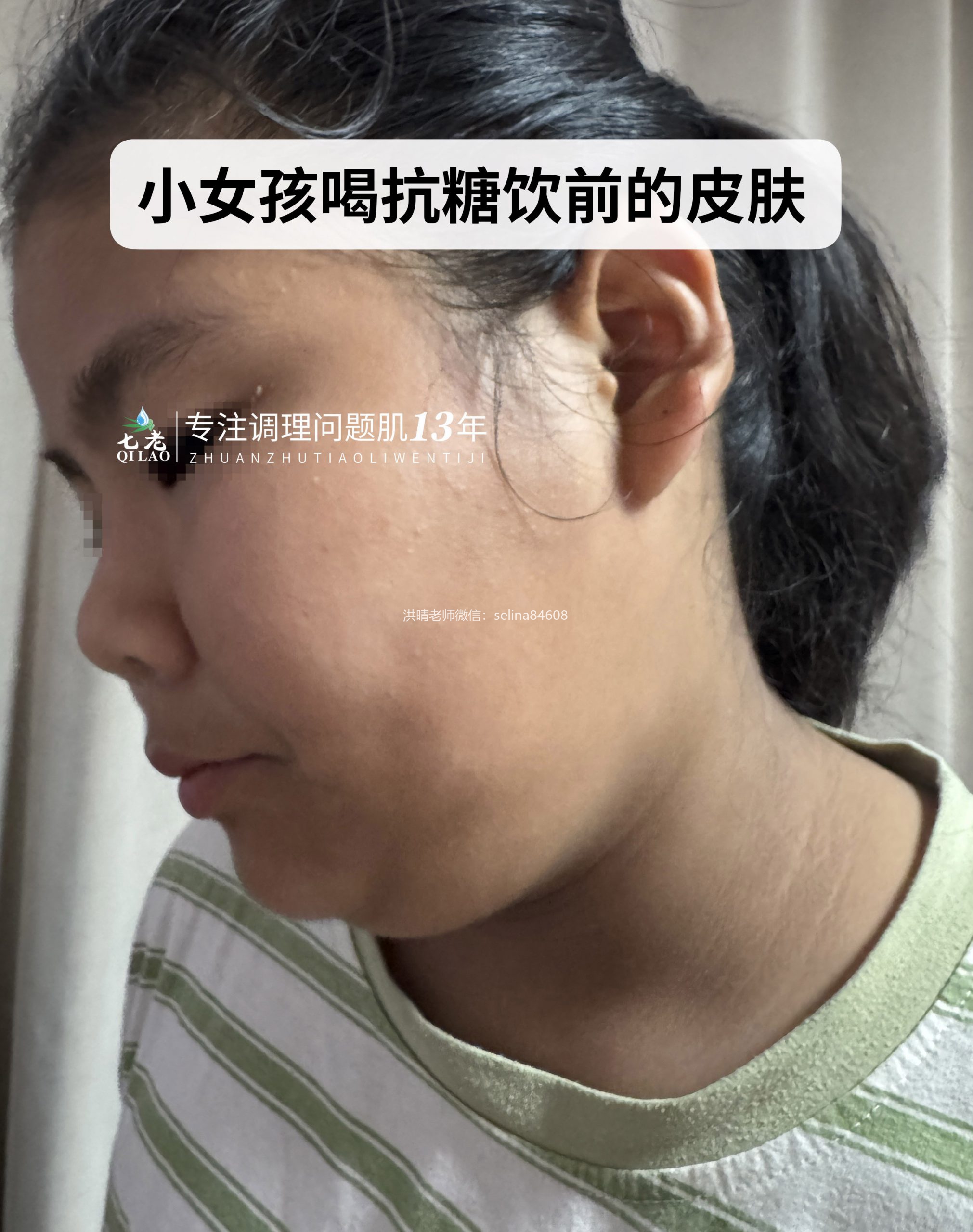 七老美白抗糖饮反馈