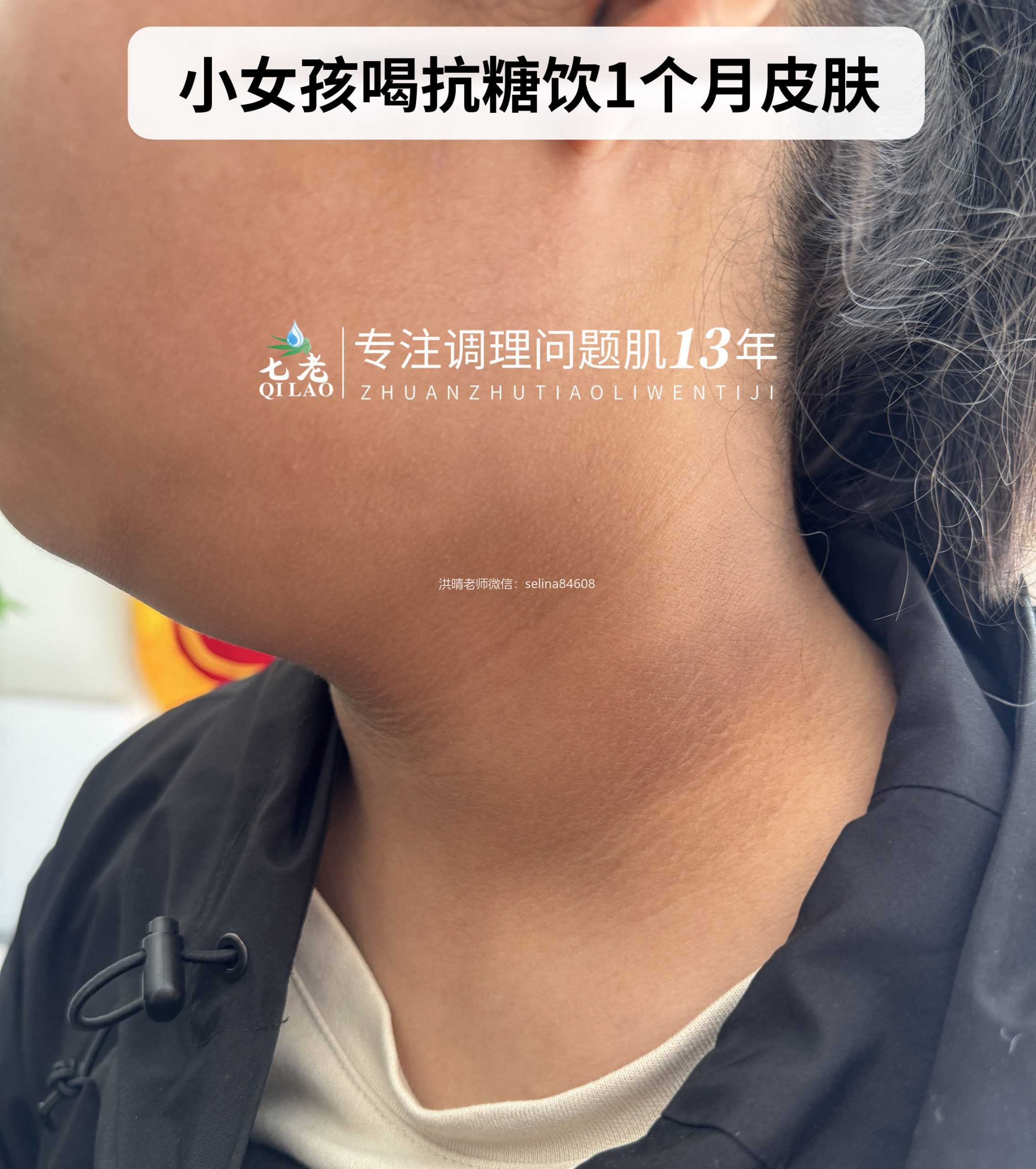 七老美白抗糖饮反馈