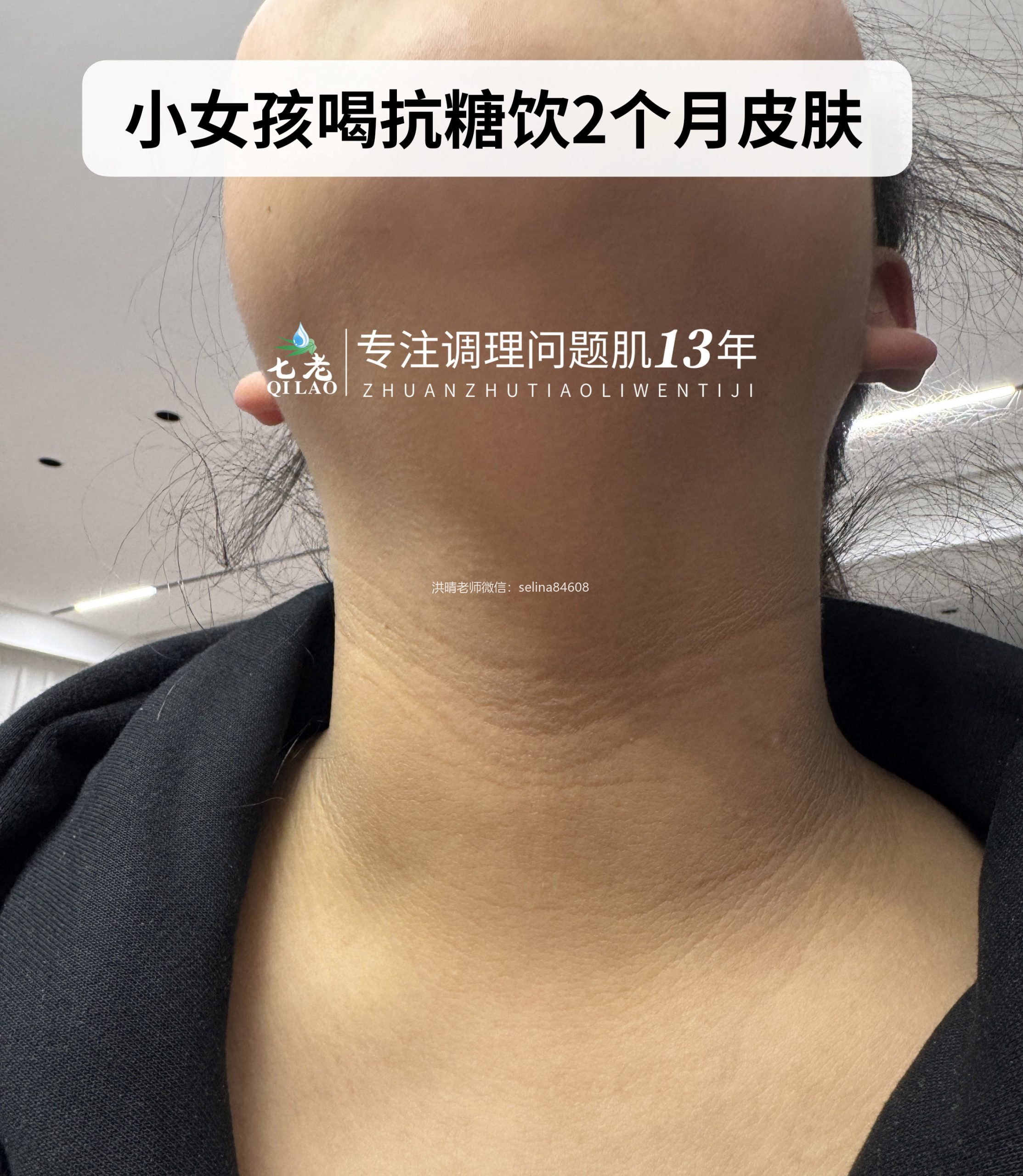 七老美白抗糖饮反馈