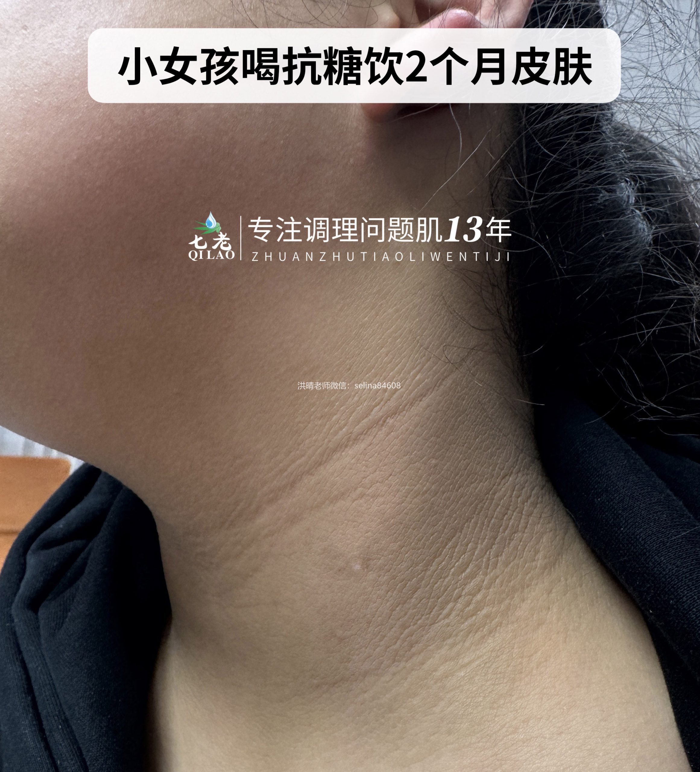 七老美白抗糖饮反馈