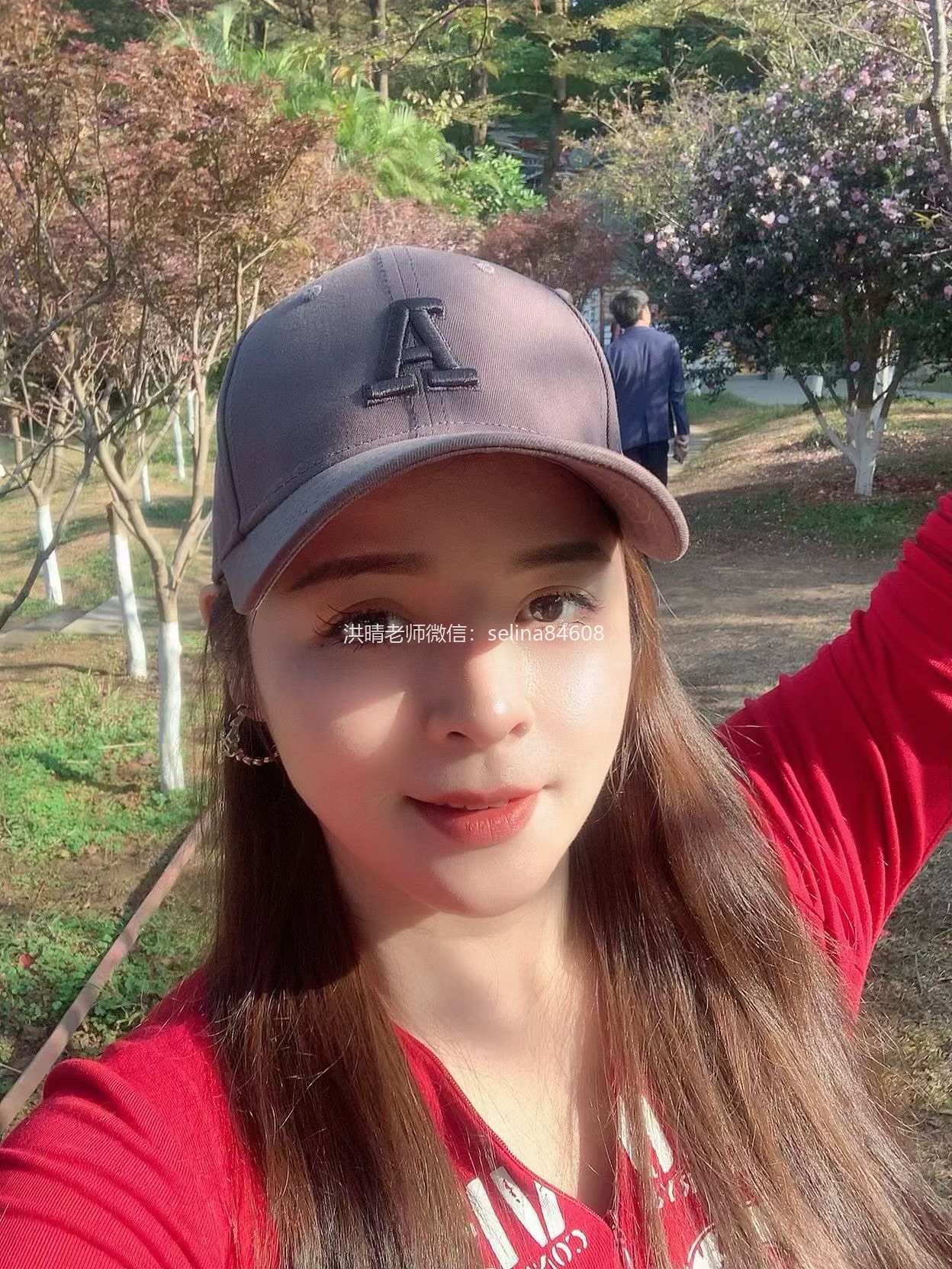 七老激素脸脂溢性皮炎修护案例