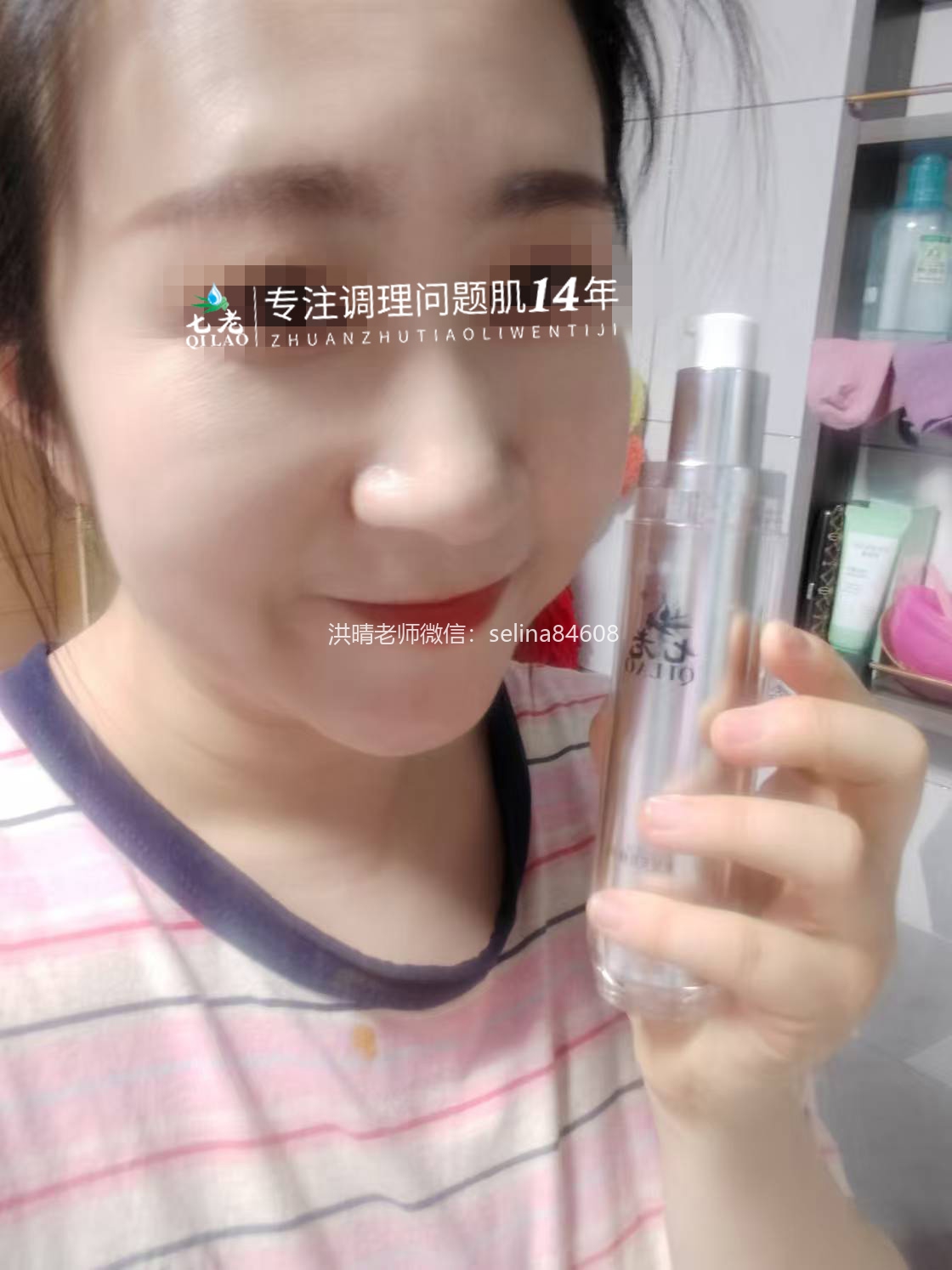 七老激素脸修复案例