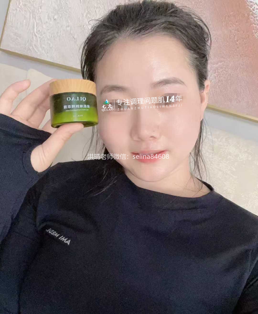 七老激素脸玫瑰修复案例