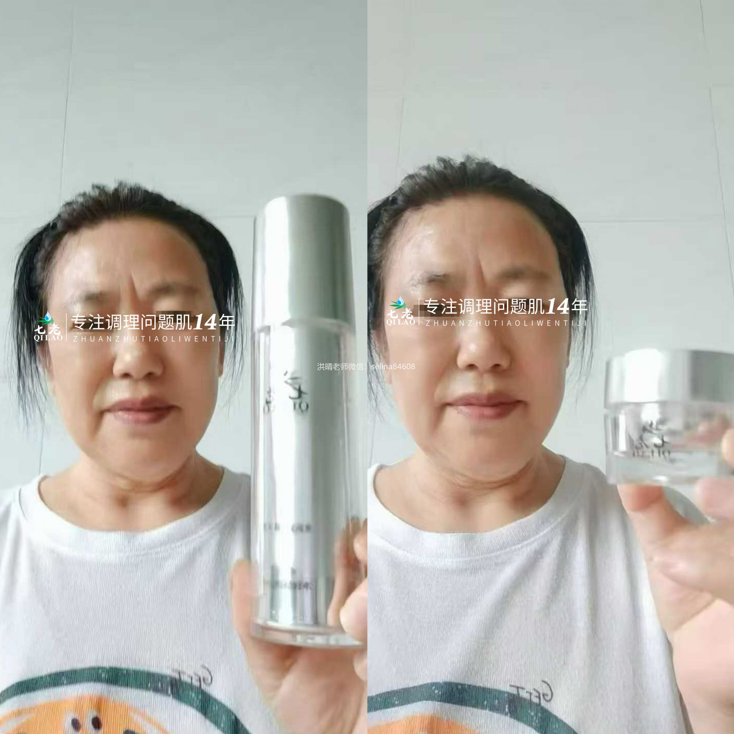 七老玫瑰皮修护案例