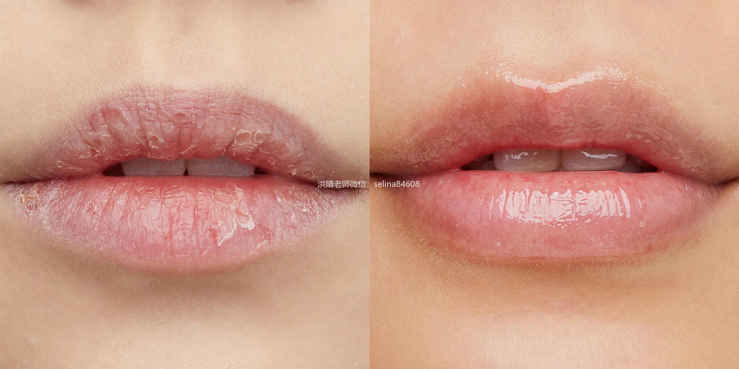 七老唇膜，超级好用，秒杀任何唇膏