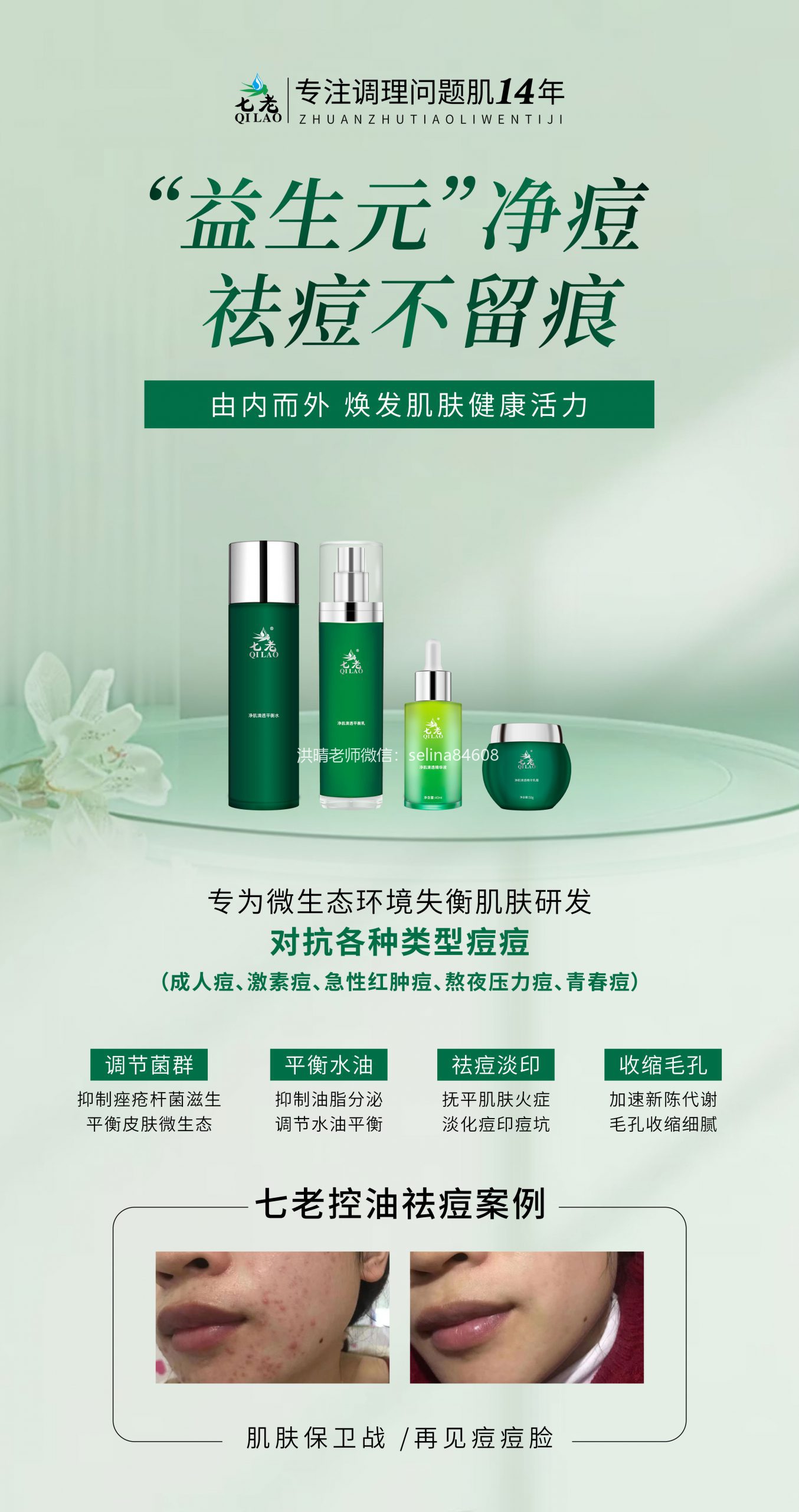七老净肌清透系列专业为大油皮，痘痘肌研发