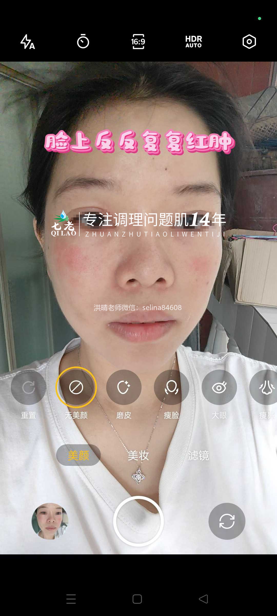 七老激素脸内调外修，恢复健康肤质，健康体质