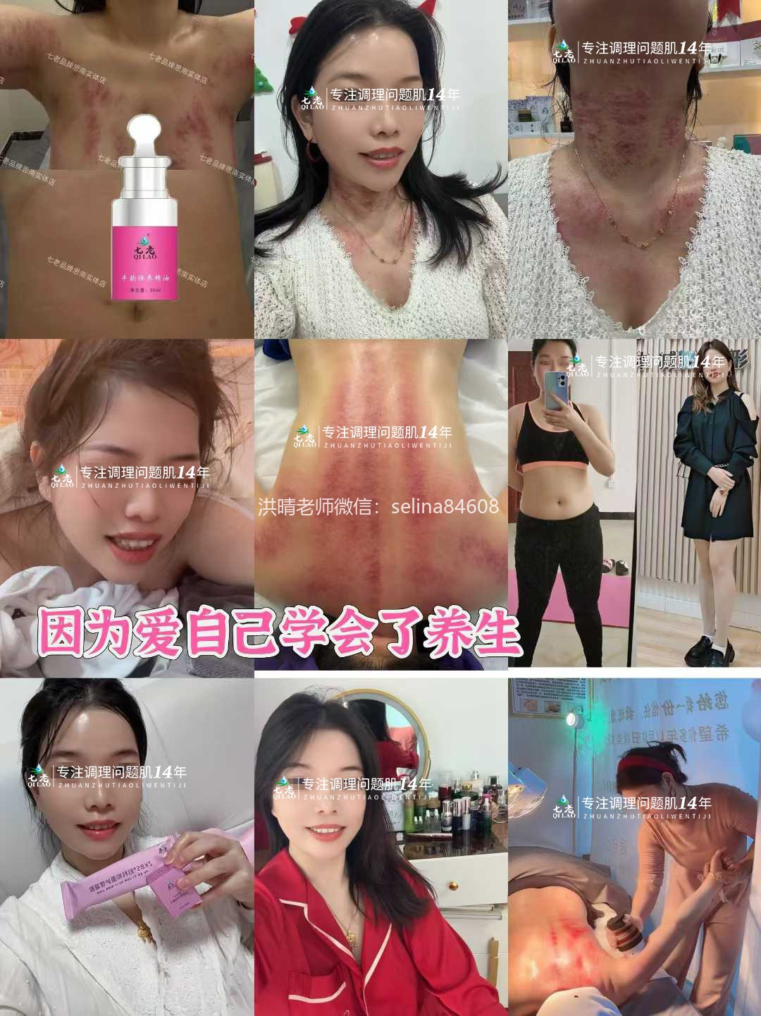 七老激素脸内调外修，恢复健康肤质，健康体质