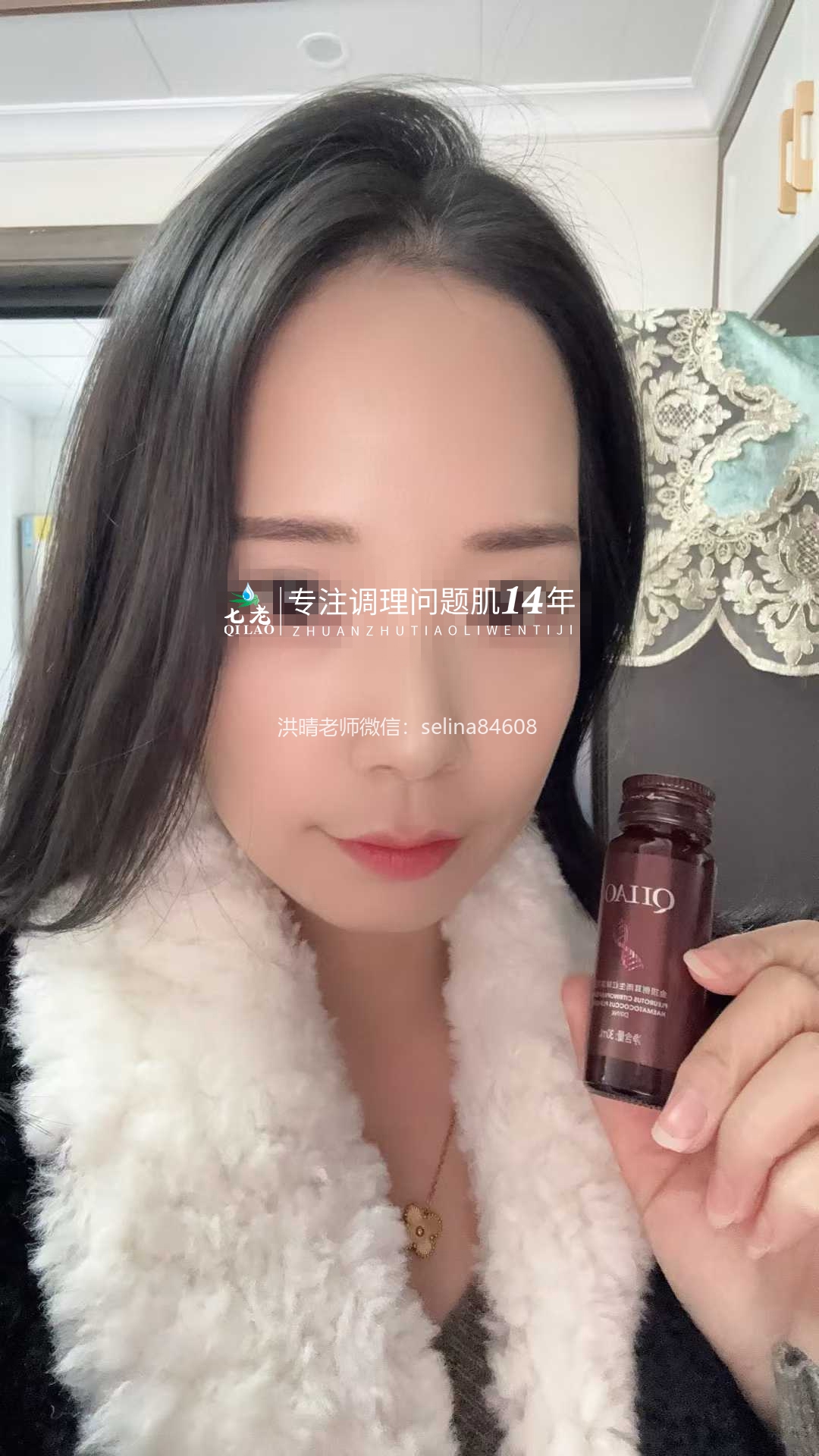 七老屏障受损角质层薄红热修复案例