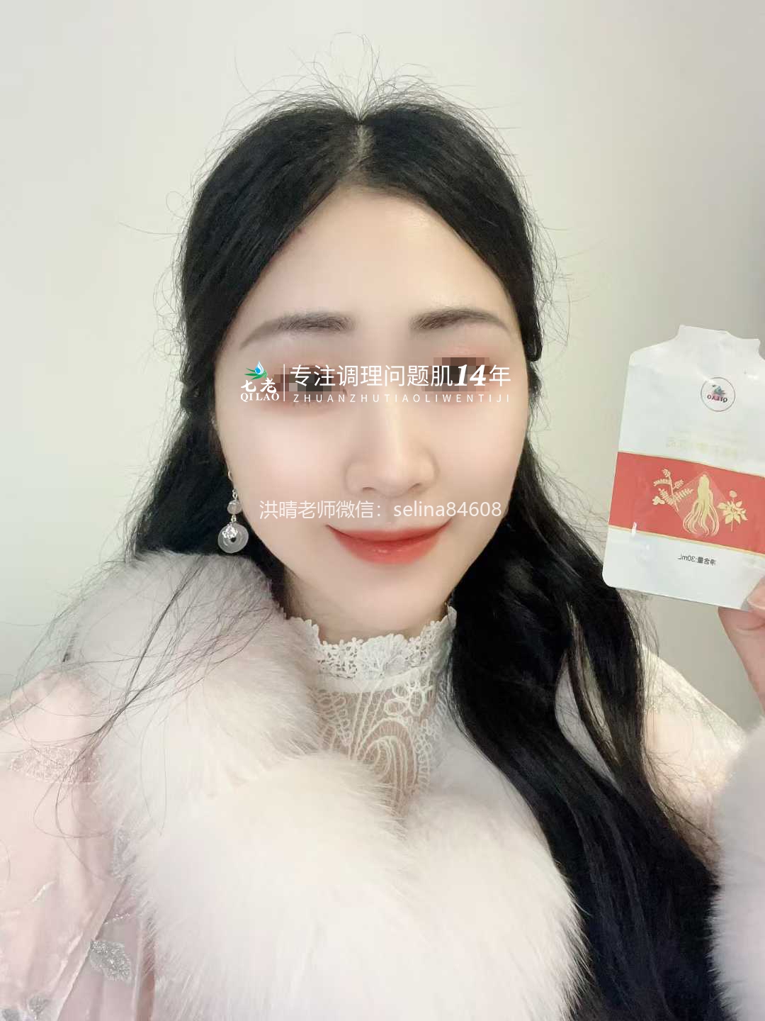 七老反复过敏修护案例