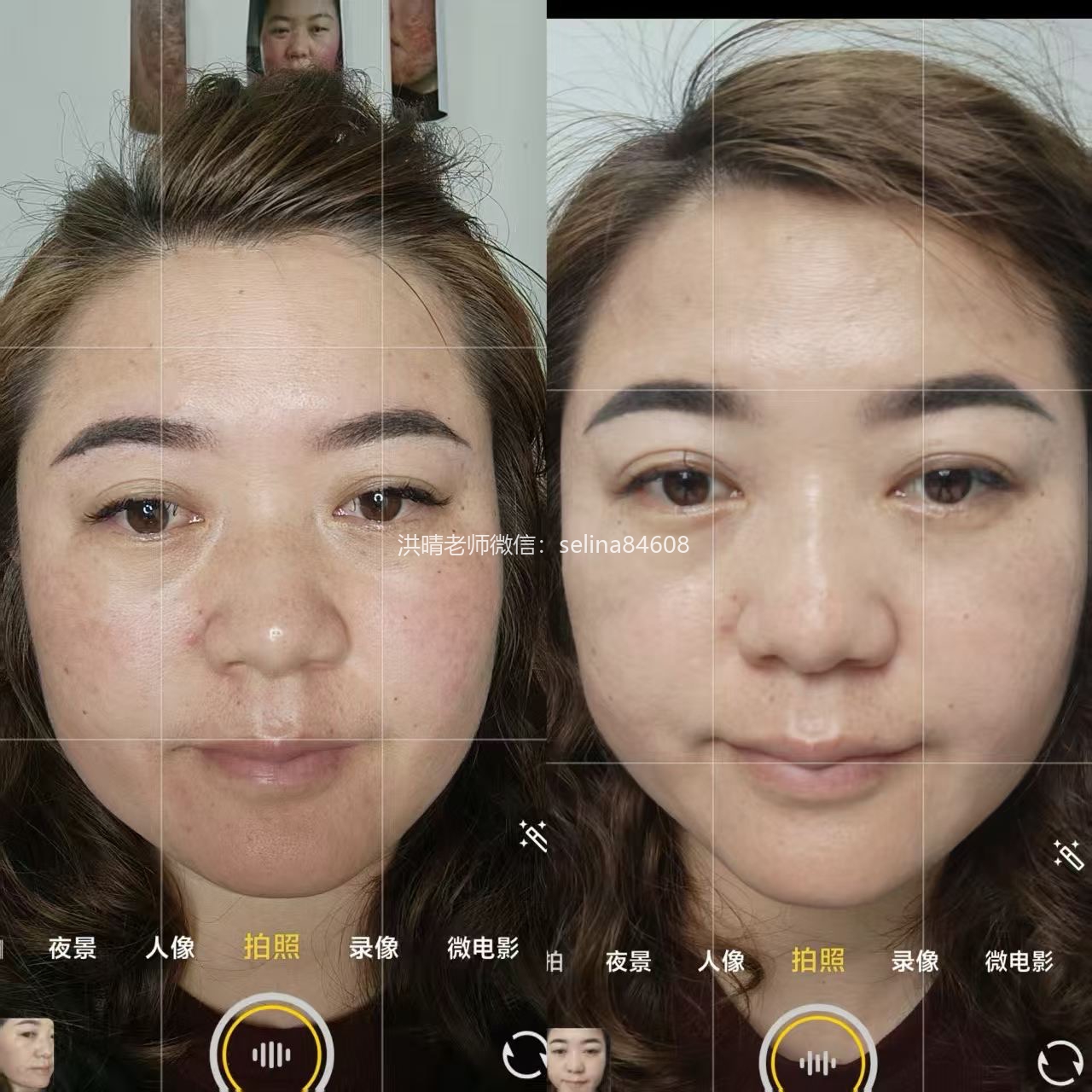 七老新品传明酸→修护抗火提亮肤色，暗沉黑红红黑地图脸一定要用起来