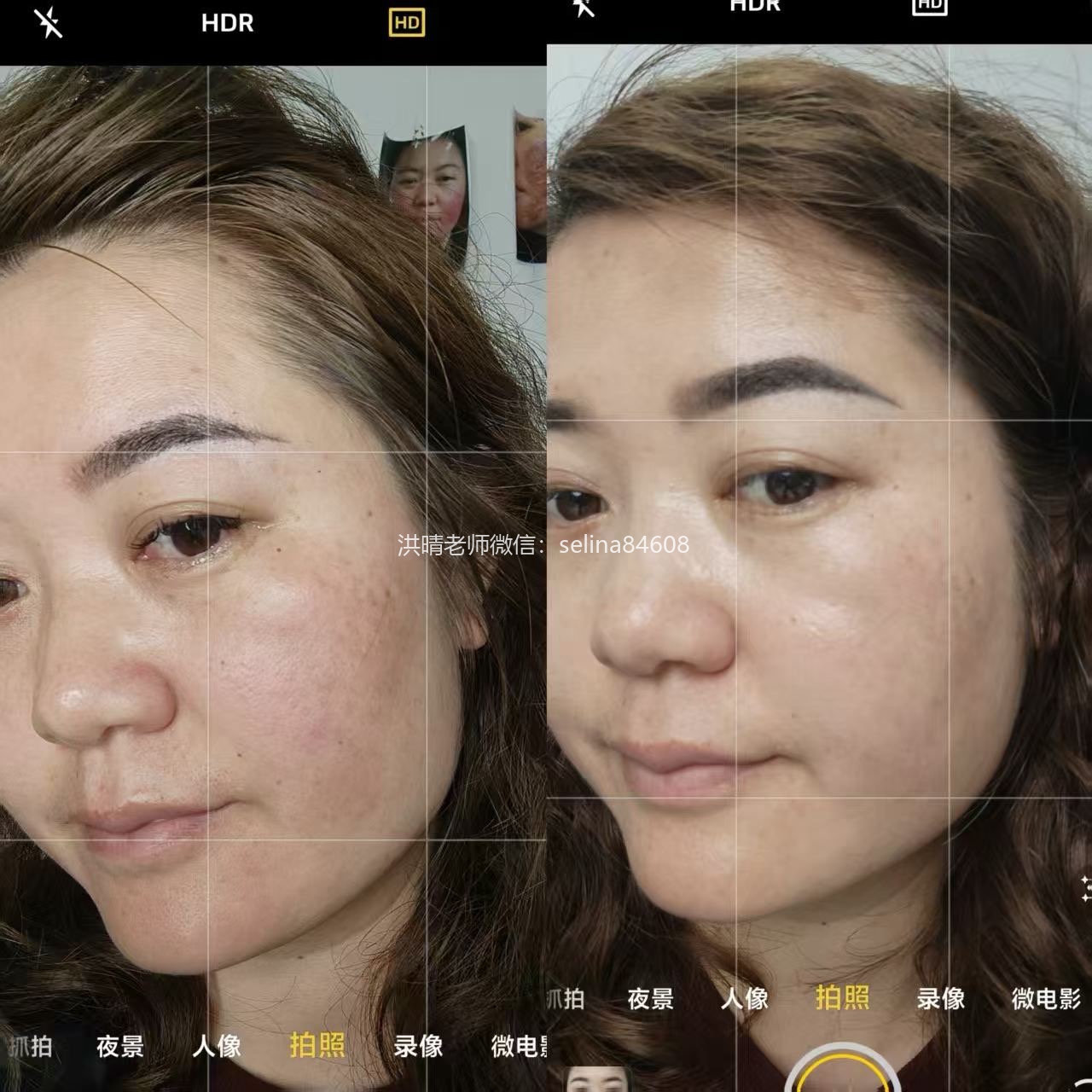 七老新品传明酸→修护抗火提亮肤色，暗沉黑红红黑地图脸一定要用起来