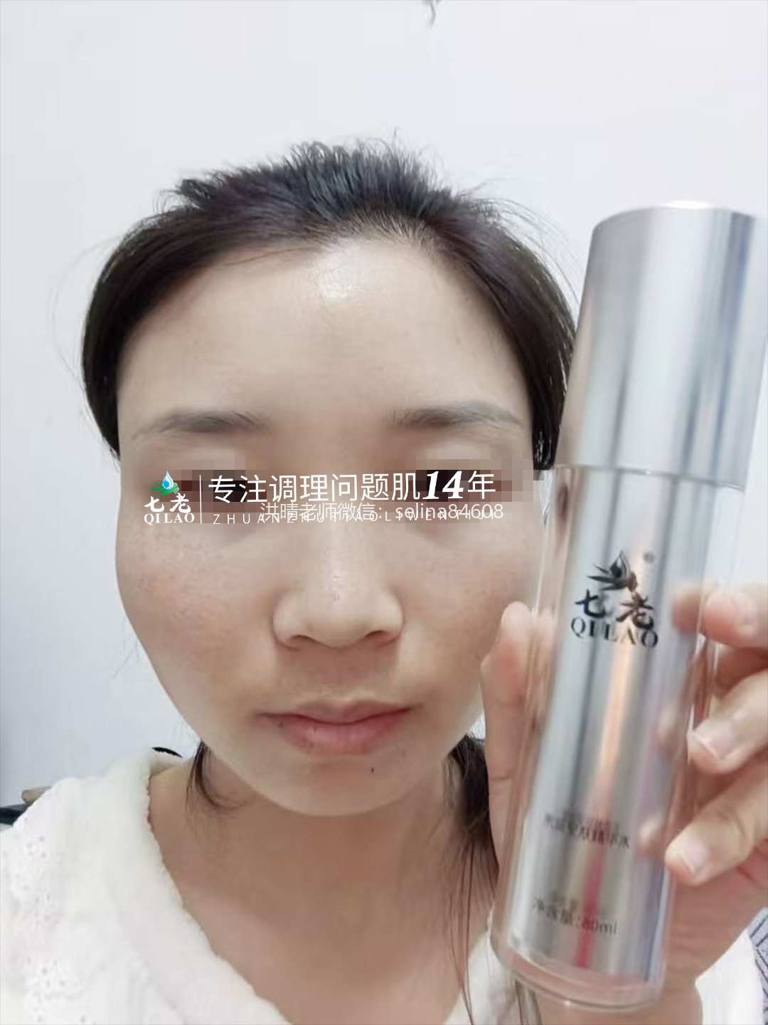 七老激素脸修护案例