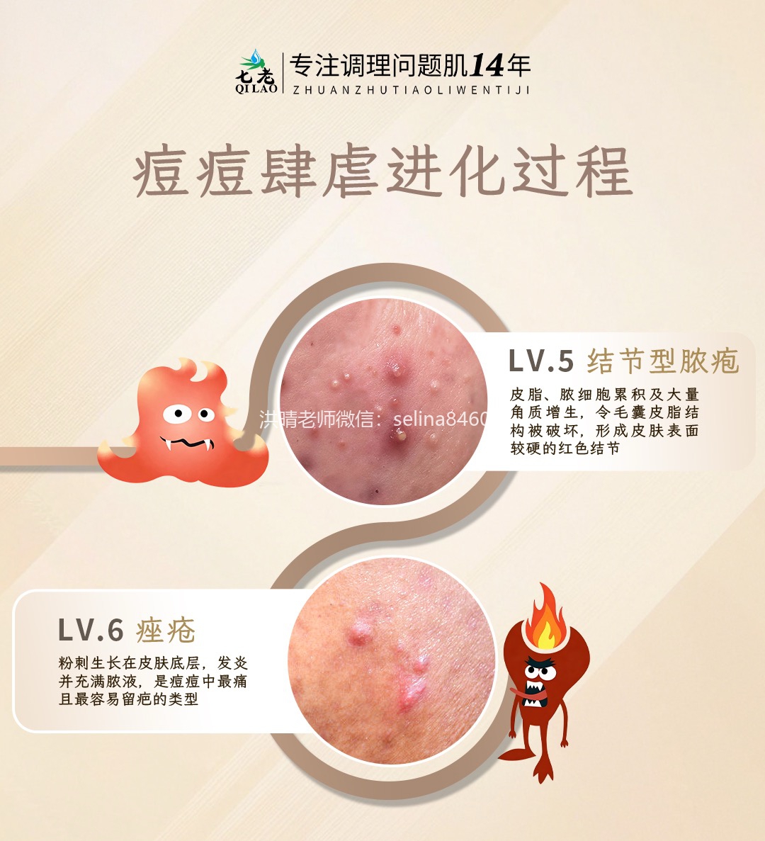 痘痘的进化过程，痘痘怎么区分？