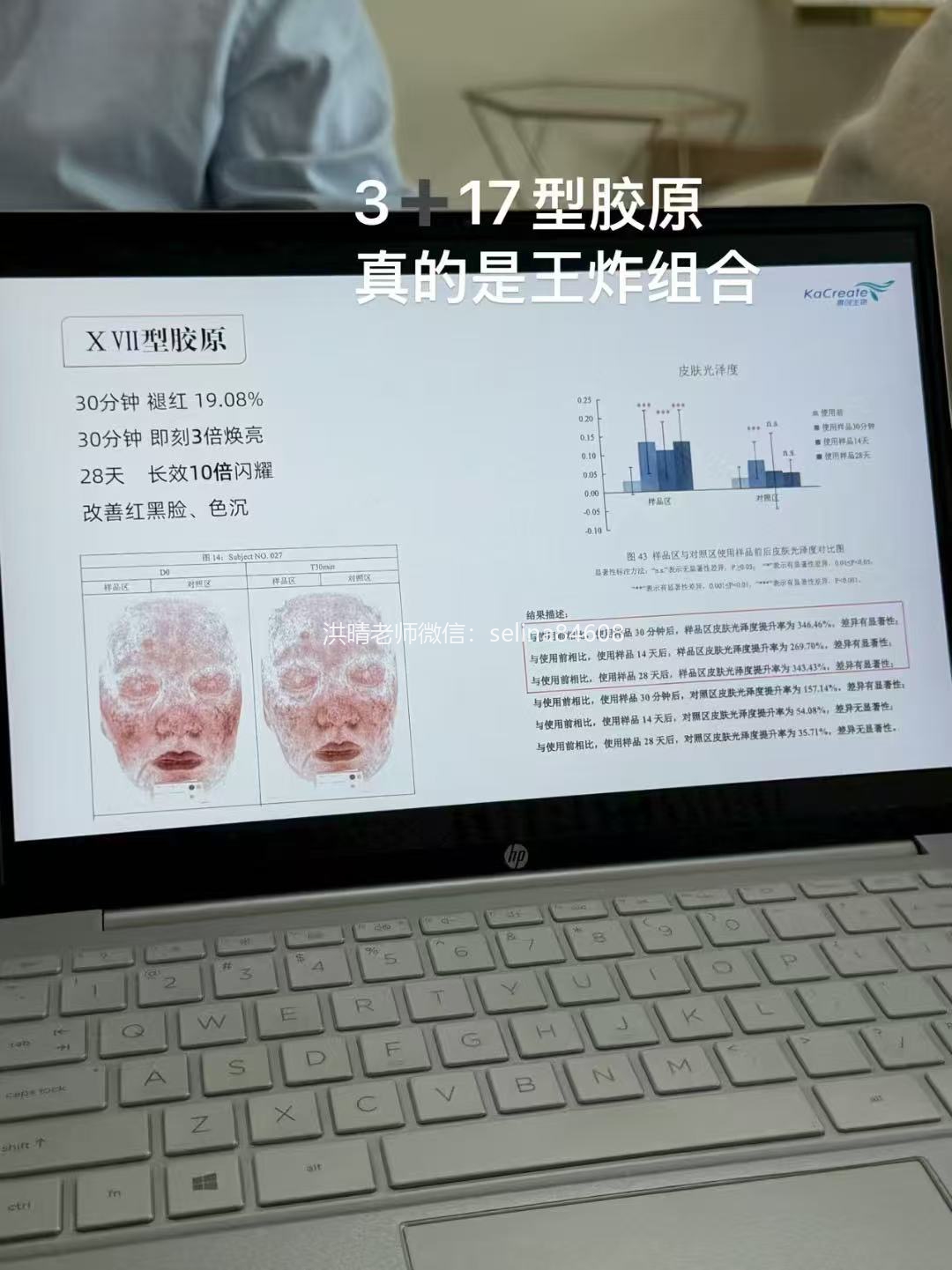 七老新品预告👉🏻胶原水光