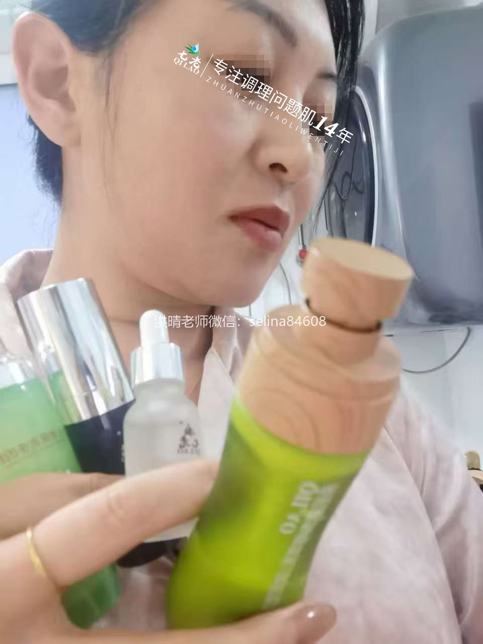 七老激素脸修护案例