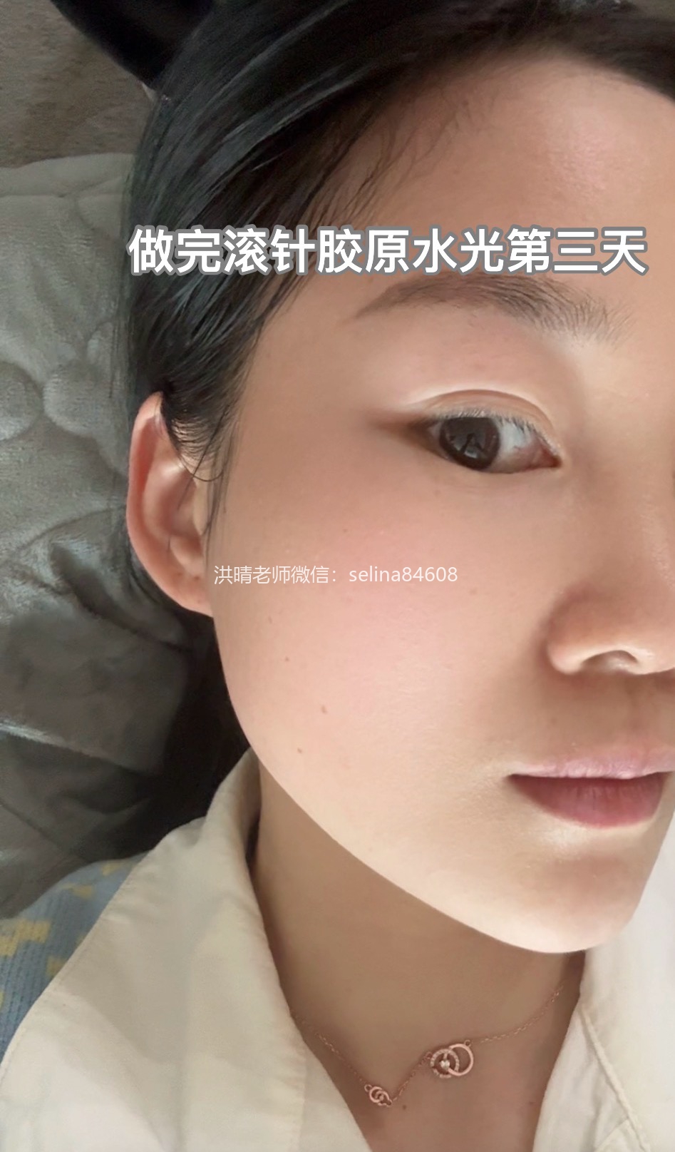 七老新品胶原水光签约官方授权