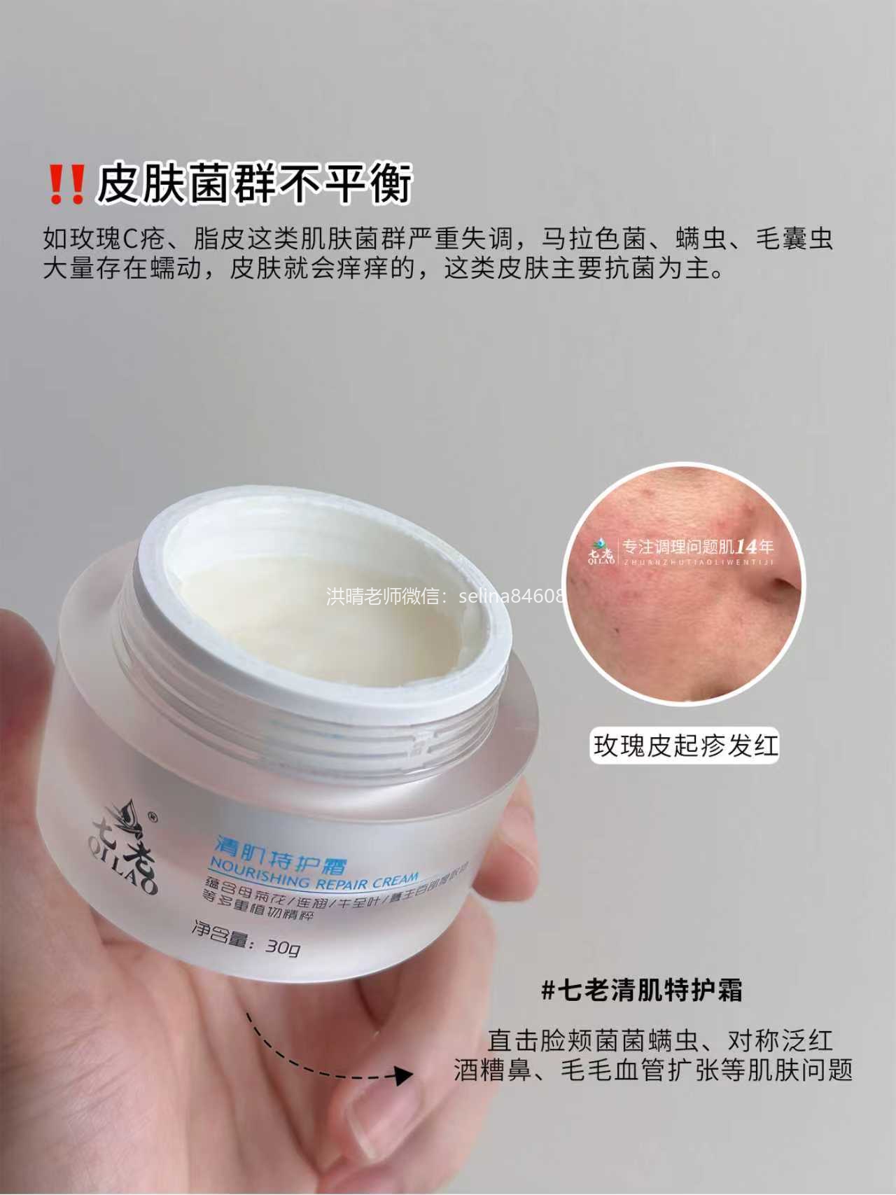 七老特护霜，调菌除螨，玫瑰痤疮疹子角栓颗粒黑头必备