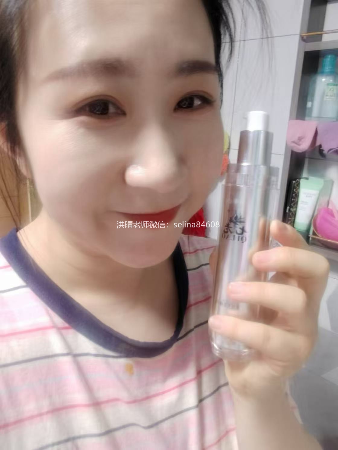 七老严重激素脸修复案例