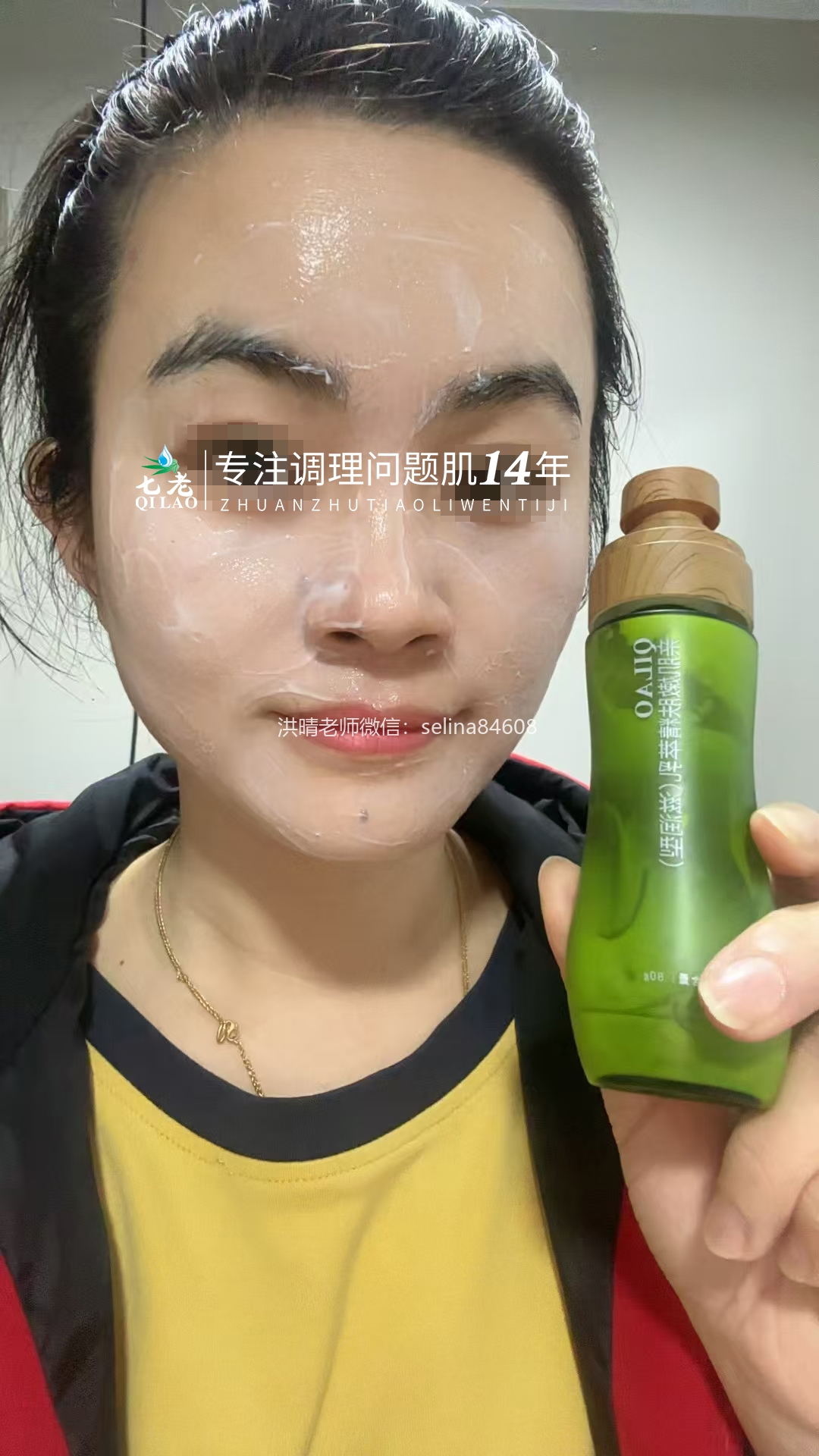 七老反复过敏修复案例