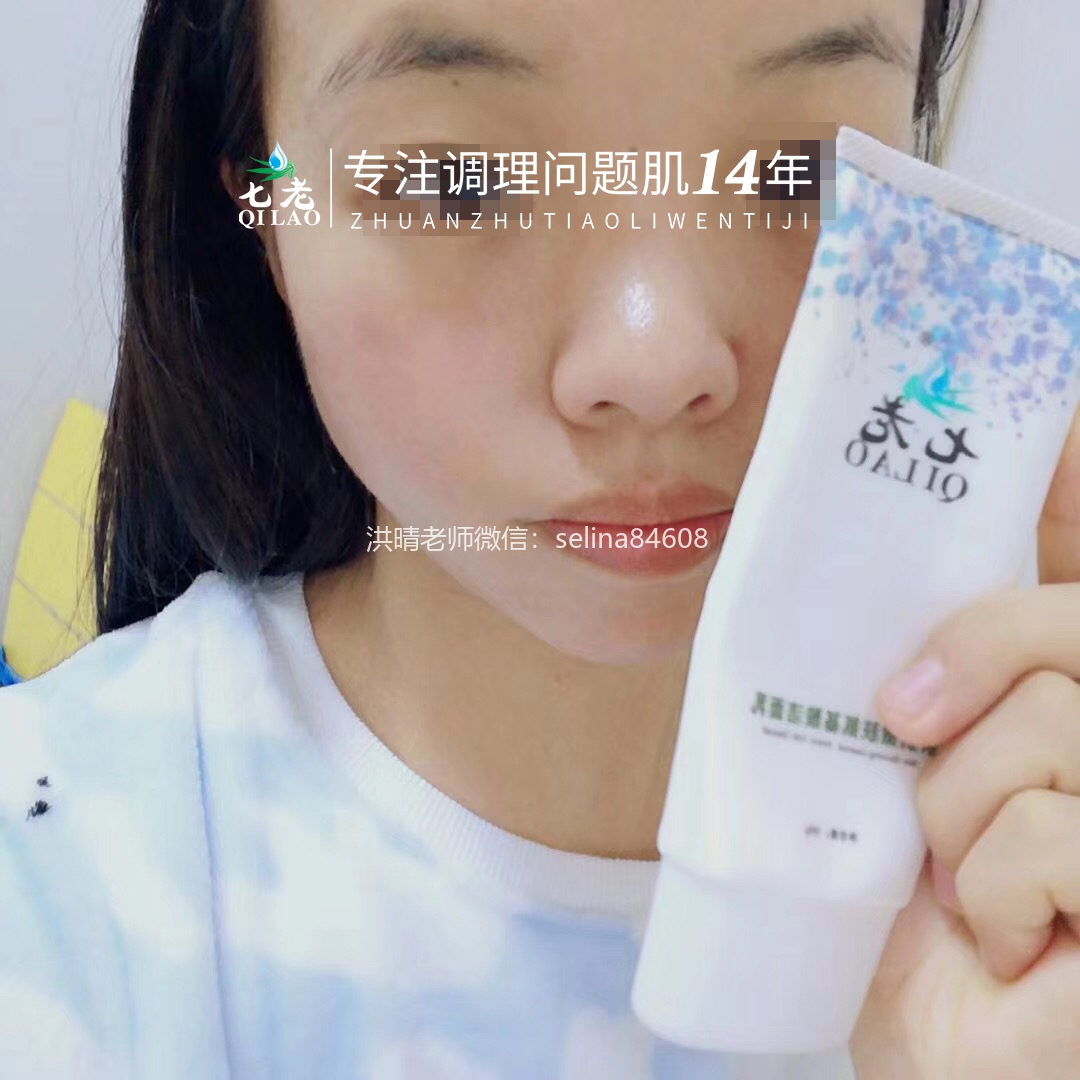 七老严重激素脸激素痘修护案例