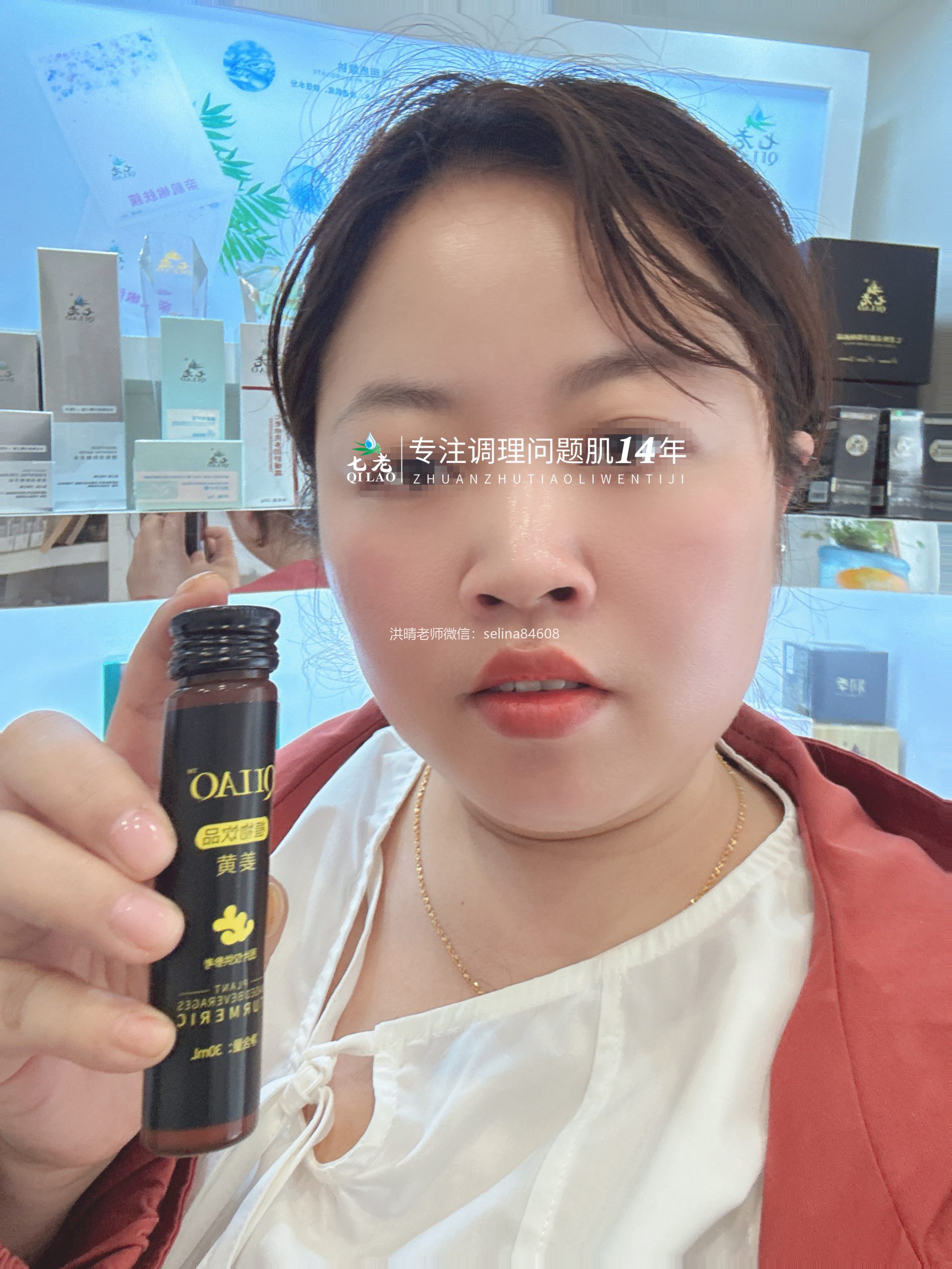 七老激素脸红肿痒反复过敏修护案例